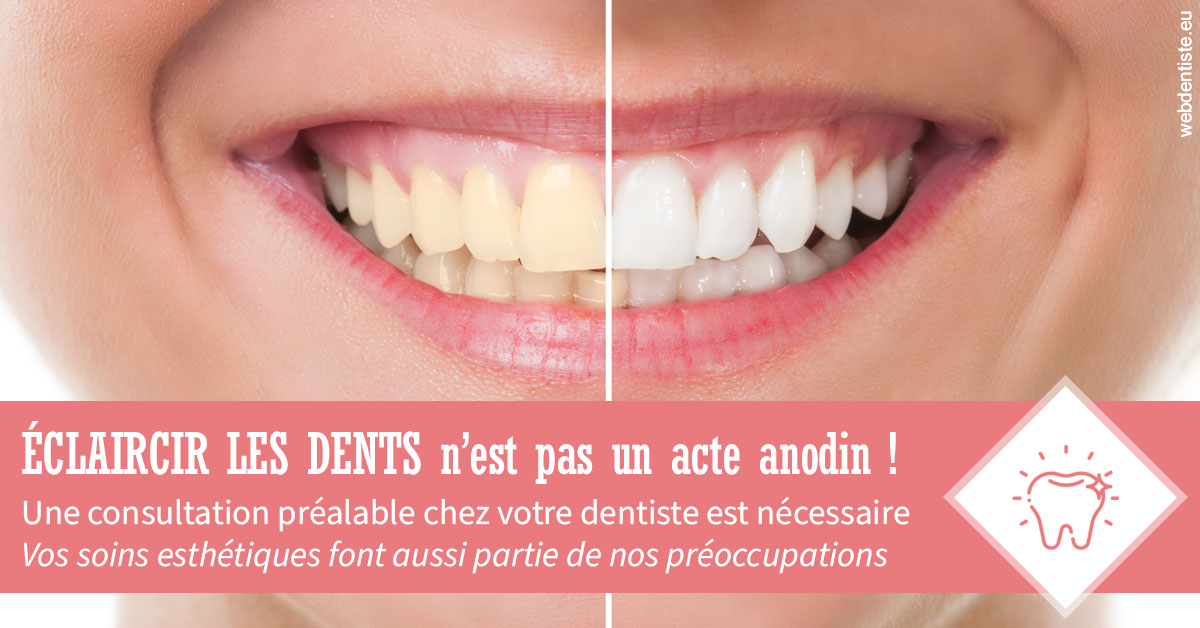 https://dr-bendahan-gabriel.chirurgiens-dentistes.fr/Eclaircir les dents 1