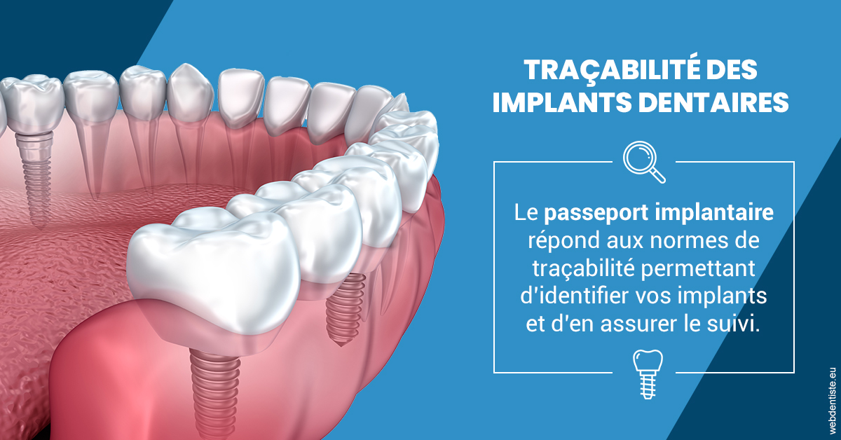 https://dr-bendahan-gabriel.chirurgiens-dentistes.fr/T2 2023 - Traçabilité des implants 1