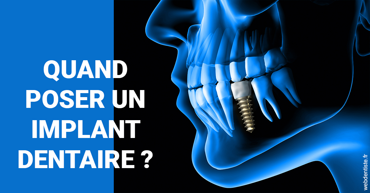 https://dr-bendahan-gabriel.chirurgiens-dentistes.fr/Les implants 1