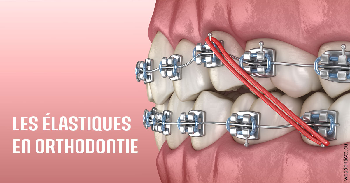 https://dr-bendahan-gabriel.chirurgiens-dentistes.fr/Elastiques orthodontie 2