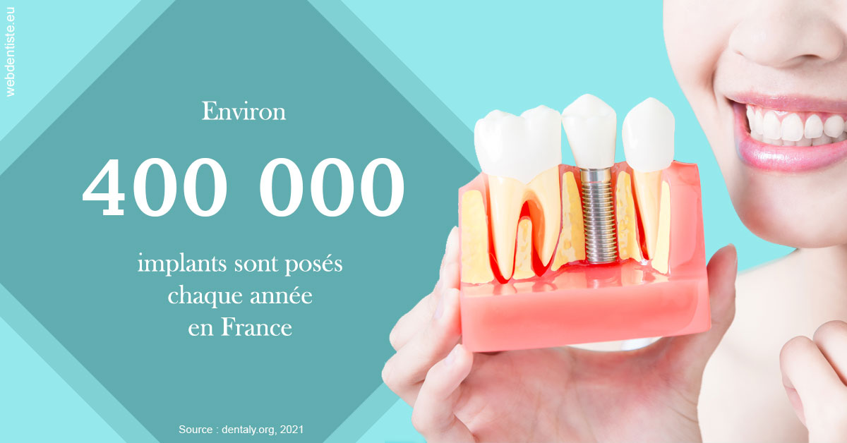 https://dr-bendahan-gabriel.chirurgiens-dentistes.fr/Pose d'implants en France 2